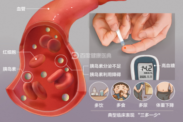 联合国糖尿病日，贝斯曼对“糖”的监督时刻进行着